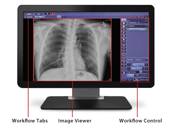 Canon CXDI Control Software NE