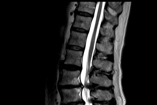 Fuji Echelon Oval 1.5T MRI