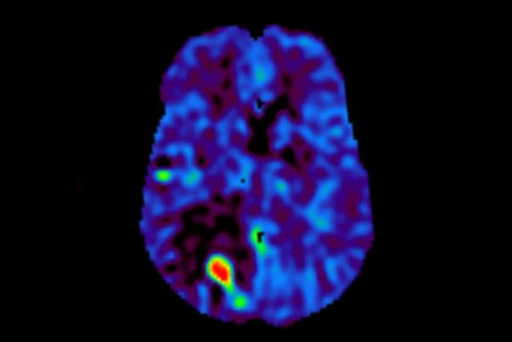 Fuji Echelon Oval 1.5T MRI