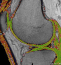 Musculoskeletal