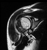 Musculoskeletal