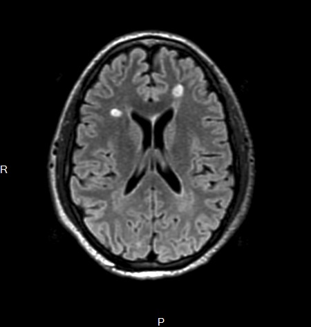 NeuroDrive