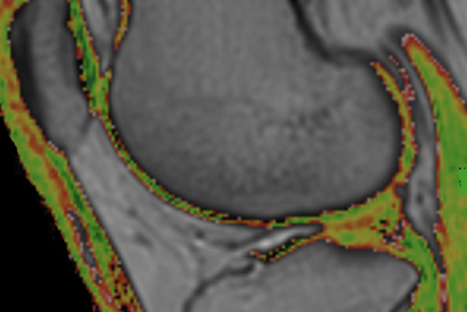 Fuji Oasis 1.2T MRI