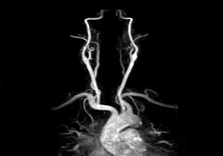 Fuji Oasis 1.2T MRI