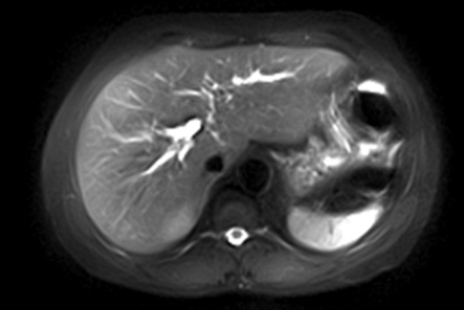 Fuji Oasis 1.2T MRI