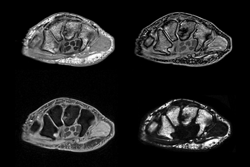 Fuji Oasis 1.2T MRI