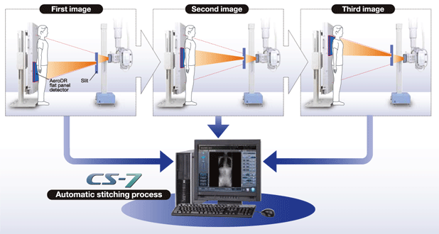 Konica Minolta AeroDR Auto-Stitching System