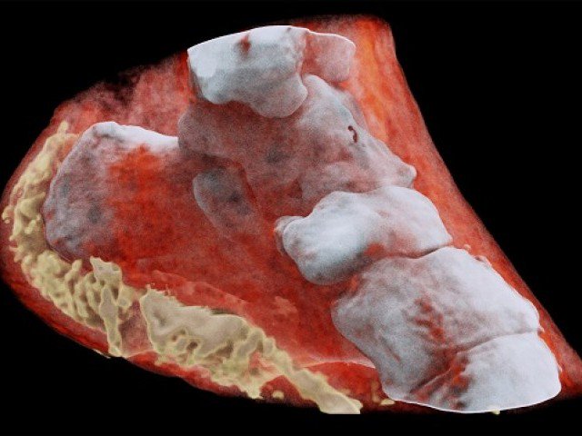 First ever color X-ray