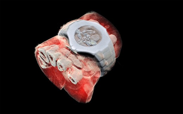 First ever color X-ray