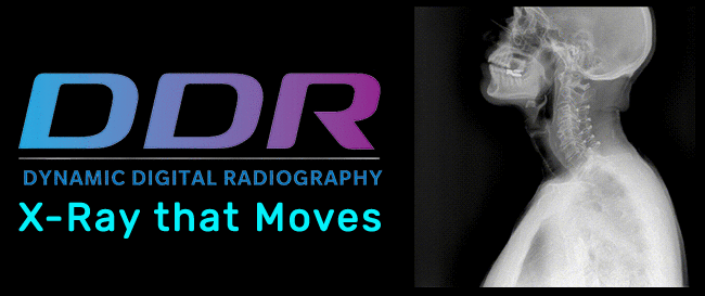 Dynamic Digital Radiography